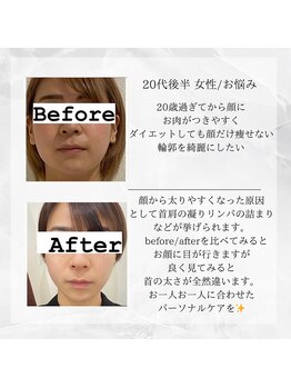 メディカルエステ 東銀座店/20代後半 女性