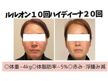 ヨサパーク ハナ(YOSA PARK hana)/