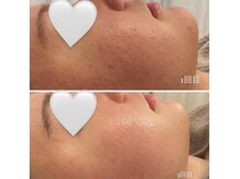 チッチ アフロディーテ(Chicchi Aphrodit)