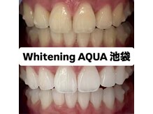 アクア 池袋店(AQUA)/ホワイトニング/池袋/東京/美白