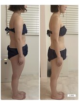 メロウプラス 錦糸町店/下半身集中ケア.セルライト撃退