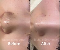 ユンプラス(yun+)