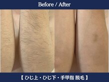 ランドマーク 中崎町(LANDMARK.)/《 腕 》