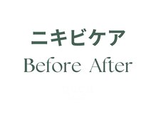 クク(ququ)/ququ beauty