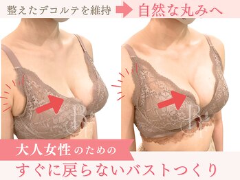 ベルフルール/ふっくらデコルテをキープ/熊本