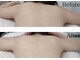 ユニクリア 佐賀(Uniclear)の写真/首肩こりを癒したい。揉みほぐしでは物足りない?!微弱電流・EMSマッサージで根本からアプローチ!