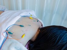 ミリグラム(mg)/３．【症状別、肩こり鍼施術♪】