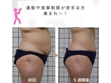 ユウェール(JUWEEL)の雰囲気（年齢と共に痩せにくい方・リバウンドを繰り返している方必見！！）