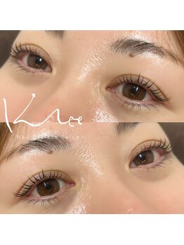 クレー(Klee)/ラッシュリフト