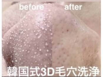 ピエナ(Piena)/毛穴が特に気になる方のメニュー