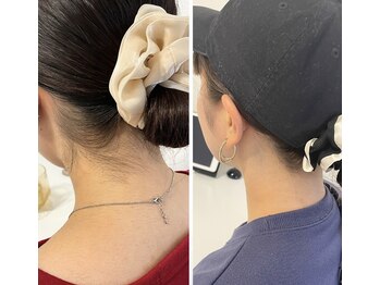 ミース 久留米店/うなじ脱毛体験1回目！