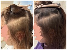 エミリエボーテの雰囲気（大人気！幹細胞スカルプケアで一気に時を戻す◎）