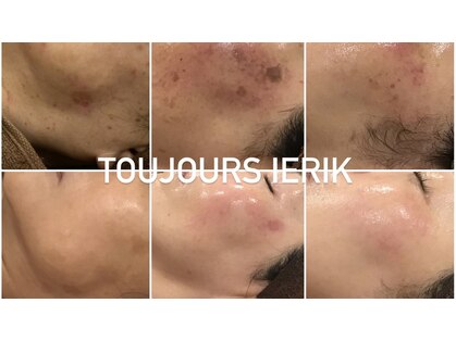 トゥジュール イエリック(Toujours ierik)の写真