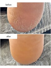 ケアプラス(care plus)/足裏角質ケア