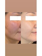 ダリア(Dahlia)/インセルダム