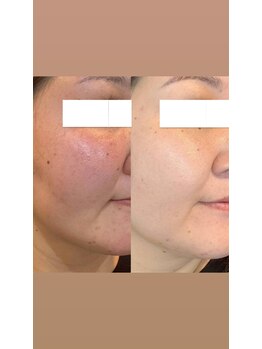 ダリア(Dahlia)/インセルダム