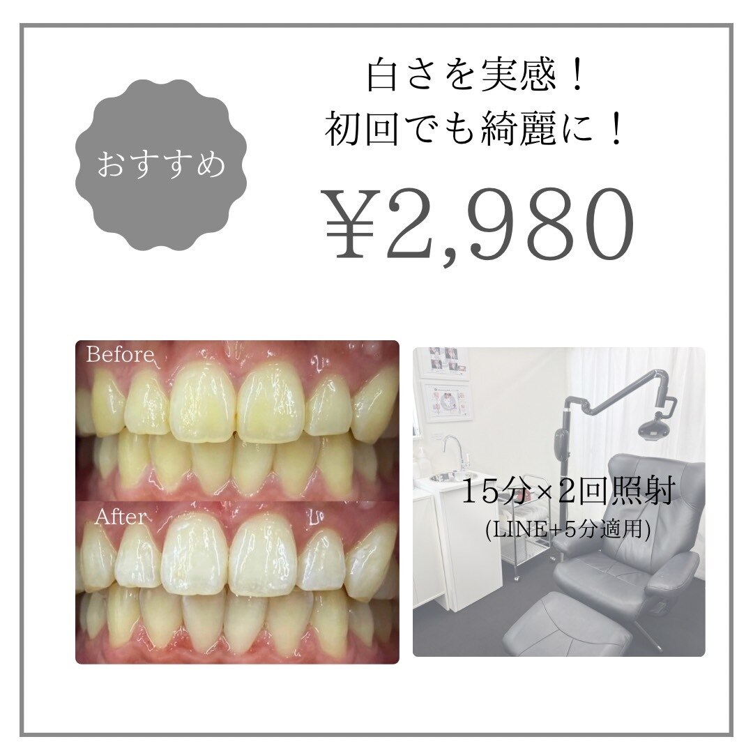 【本町・心斎橋】迷ったらこれ！初回限定☆白い歯デビュー\2,980