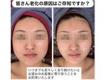 フローラの雰囲気（小顔コルギと相性の良い石膏パックで、毛穴も引き締め美白効果）