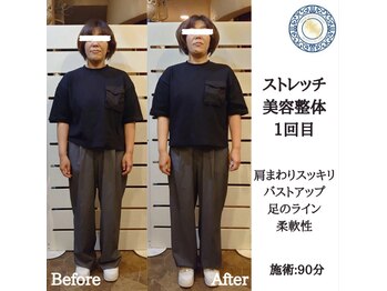 RKY/肩掛けバックが落ちるのは歪み