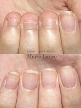マリーロール 梅田店(Marie Laure)/自爪育成/深爪矯正/ネイルケア