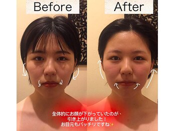 アジール 長岡リバーサイド千秋店(agir)/Before/After画像