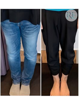 リベスト(RE:BEST)/当院の<骨盤+O脚矯正>効果