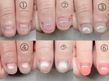 プチムトン 鶯谷店(petit mouton)/【深爪矯正コース】3