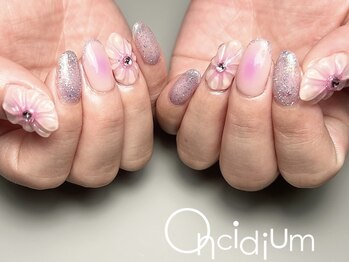 オンシジューム(Oncidium)/