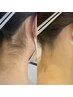 うなじダブル脱毛＿女性　新規/4000円　再来/5000円