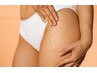 皮膚のたるみ・肉割れ　あきらめないで！話題の高周波ケアで解決！