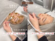 ベル 渋谷(belle)/選べる施術1