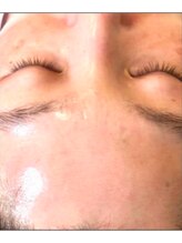 リベル 名古屋(Lebelle:)/ハーブピーリング専門名古屋