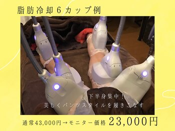 ブルースター 上小田井店(Blue Star)/脂肪冷却/6カップ