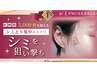 【ミテゴを見た方ご予約専用】先着30名様限定!!シミ改善集中コース¥5000