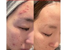 サロン ド ヴェール 四日市店(Salon de Vert)/繰り返し治らないトラブルケア