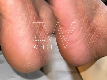 ホワイト(WHITE)/