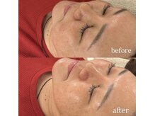 アリー(Aliiy)/美顔フェイシャルエステ