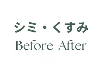 クク(ququ)/シミケア・しわケア・くすみケア