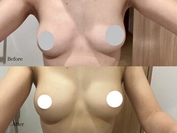 育乳整体&バストアップ専門店 Laurino salon【バストアップ/整体/姿勢改善/産後】/左右差でお悩みの方にも◎