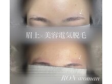 サロンロンウーマン(SALON RON woman)/眉毛脱毛