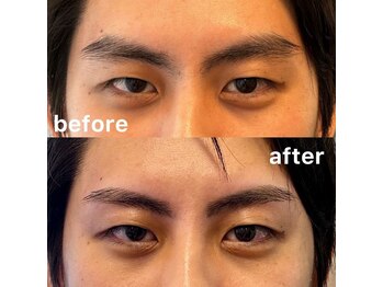 スター 新宿 新宿御苑(★STAR)/施術中メンズ眉毛WAX/新宿