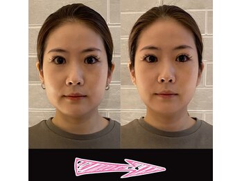 ネルジム 札幌店(NERU GYM)/小顔矯正