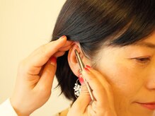 天使の耳/痛みは全くありません