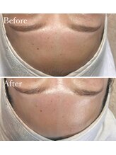 ホワイトワックス 京都四条烏丸(WHITE WAX)/《全顔》フェイシャルワックス