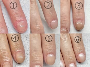 プチムトン 鶯谷店(petit mouton)/【深爪矯正コース】4