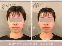 ほぐし屋 かすがい/小顔リフト矯正＋美姿勢整体