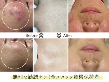 ビズビズ 梅田店(bisebise)