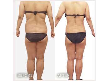 えすてさろん ケイアンドエフ(k&f)/しなやかなラインの健康美へ30代