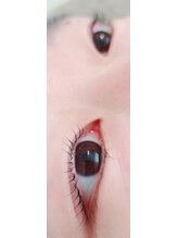 コア(Koa)/パリジェンヌリフト