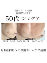 顔専門エステ 印西店/50代シミケア